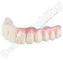 Wzmocniona żywica tymczasowa Temp Ultra (A-B) 1 kg - Temporary Crown & Bridge Resin Temp Ultra (A-B Shades) 1 kg - Arma Resin