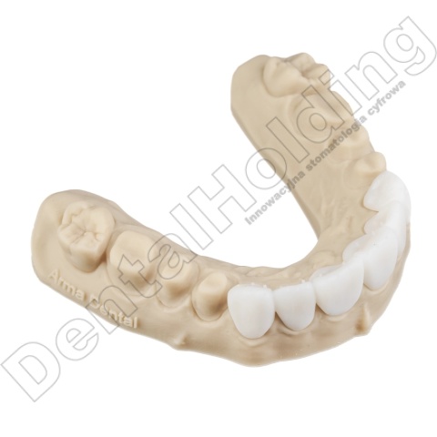 Wzmocniona żywica tymczasowa Temp Ultra (A-B) 1 kg - Temporary Crown & Bridge Resin Temp Ultra (A-B Shades) 1 kg - Arma Resin