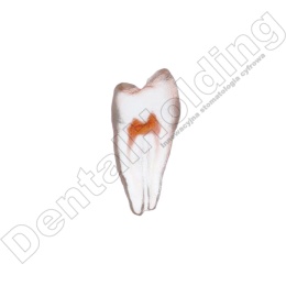 Ząb treningowy Premolar B(open) - przedtrzonowy B (otwarty)