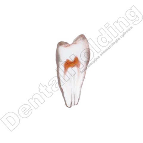 Ząb treningowy Premolar B(open) - przedtrzonowy B (otwarty)