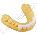 Żywica do tymczasowych koron i mostów Temp (A-B) 1 kg - Temporary Crown & Bridge Resin Temp (A-B Shades) 1 kg - Arma Resin