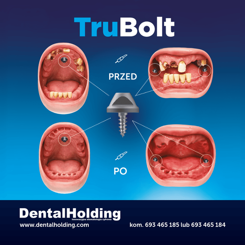 TruBolt